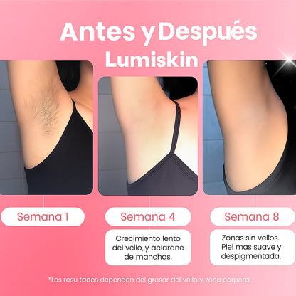 Depilador Laser Corporal Dama